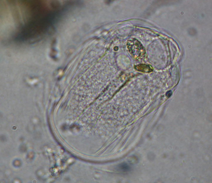 显微镜下的变形虫
