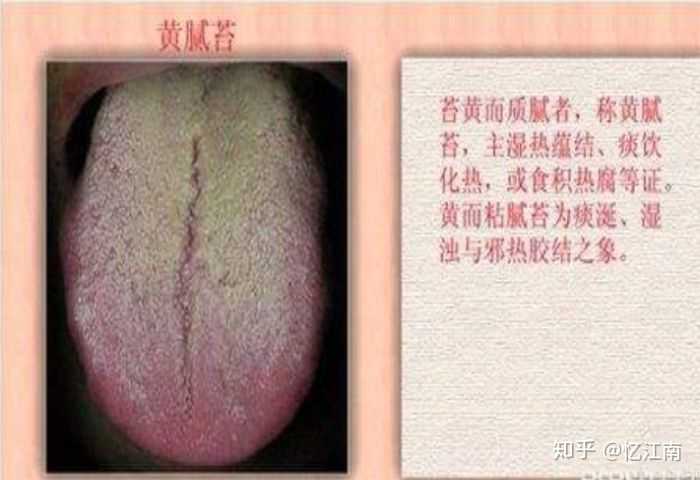 1,口气重,舌苔厚腻