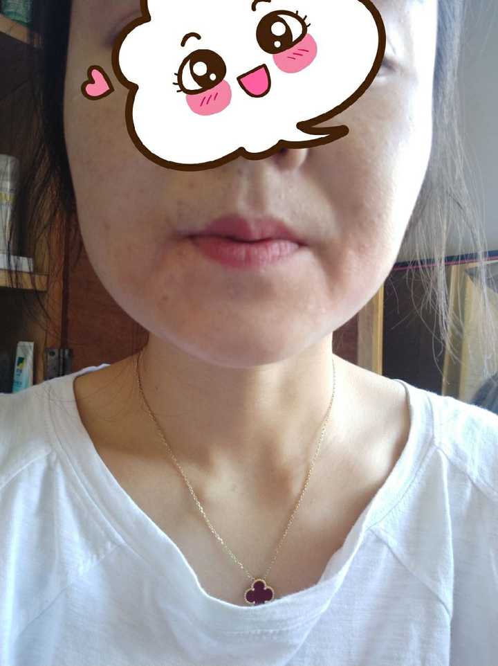 有哪些过敏症状?你分得清过敏和感冒的区别吗?