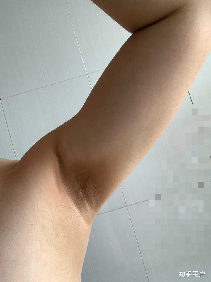 有人不长腋毛吗?