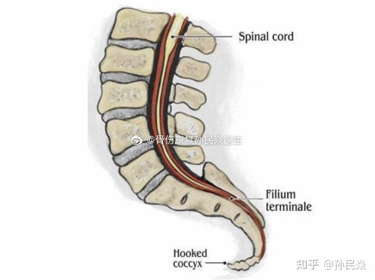 孙民焱 的想法: 今日工作心得 钩状尾椎 hooked coccyx 一… - 知乎