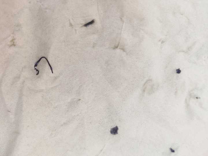 拔智齿后,缝针的线,可以自己拆吗?