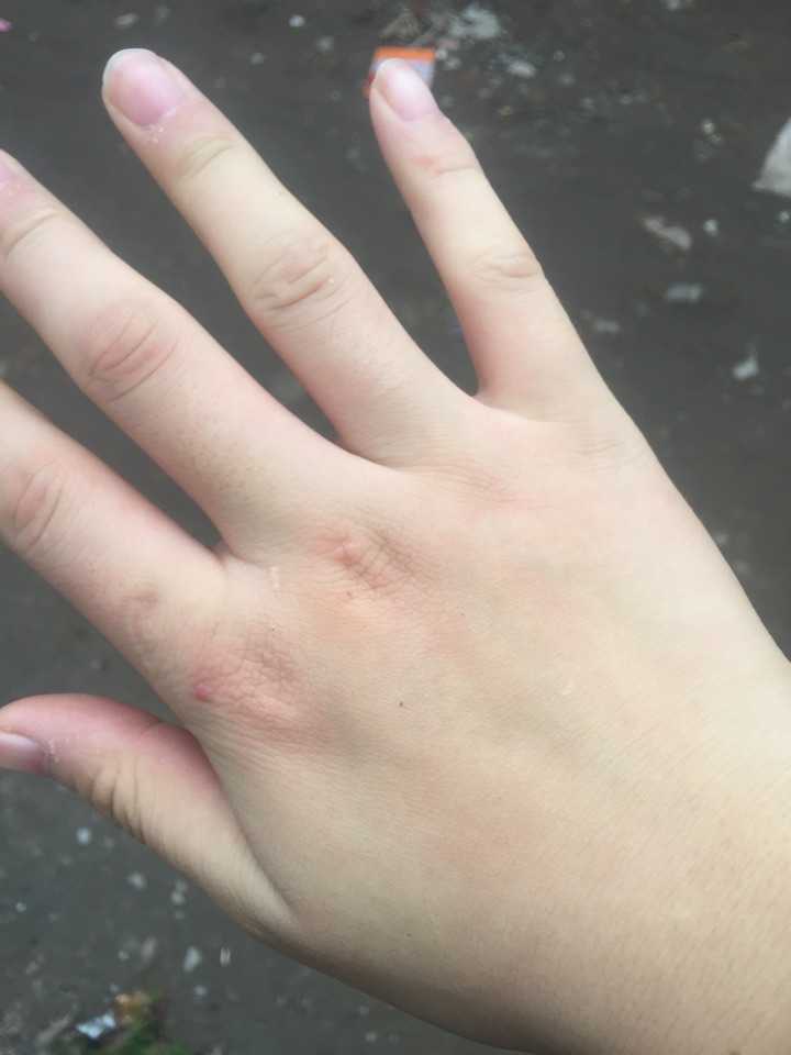 胖手,被女朋友耻笑过
