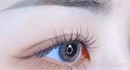 开外眼角是什么体验?