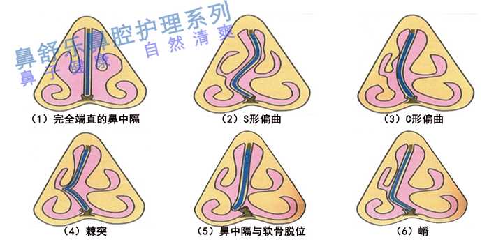 为啥要买商业保险 买哪种商业保险比较好