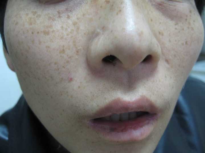 怎么可以淡斑啊?