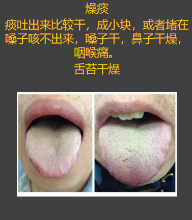 雷师兄健康 的想法: 早上起来痰多,吐黄痰,白痰,黏痰