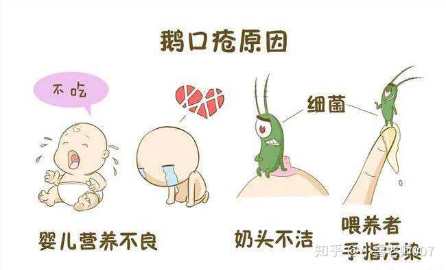 婴儿鹅口疮图片