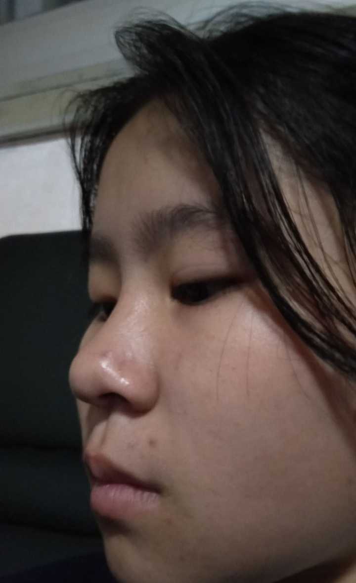 眼睛一单一双是什么体验?