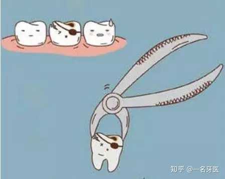 吃东西老塞牙怎么办?