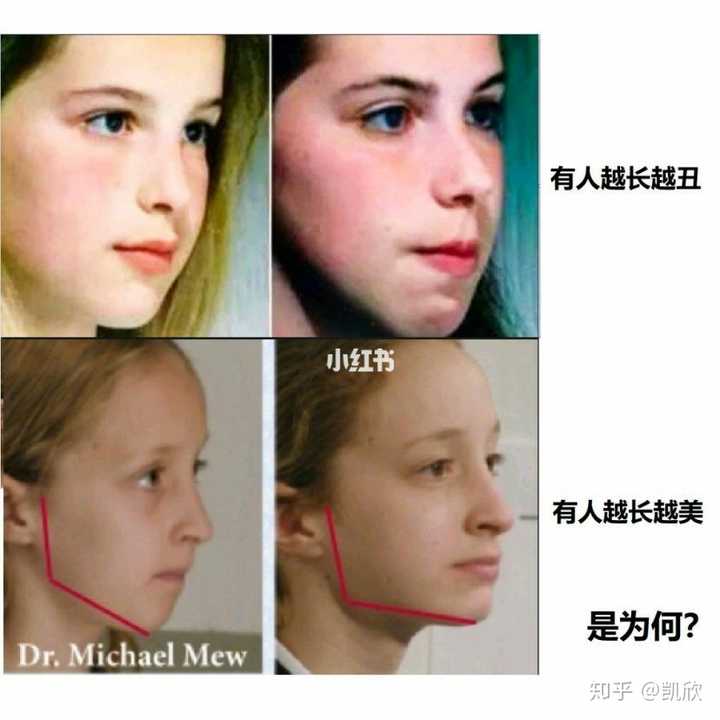 mew教的改变脸型方法总结,开发你基因里最美的潜力