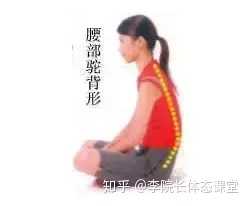 后果: 腰部驼背姿势持续的结果,背中部及腰部的肌肉常年被拉直,初时常