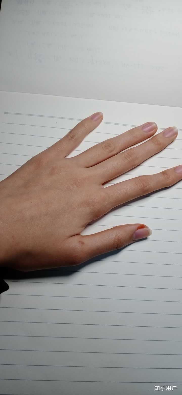 撇手指真的会让指关节变粗吗
