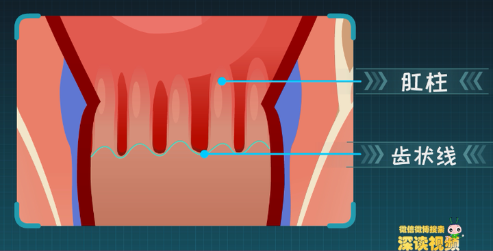 肛柱底下有条锯齿一样的线,医学上叫 齿状线.