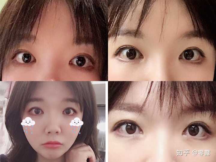 下垂眼是一种怎样的体验?