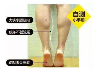 此外肌肉型小腿情况