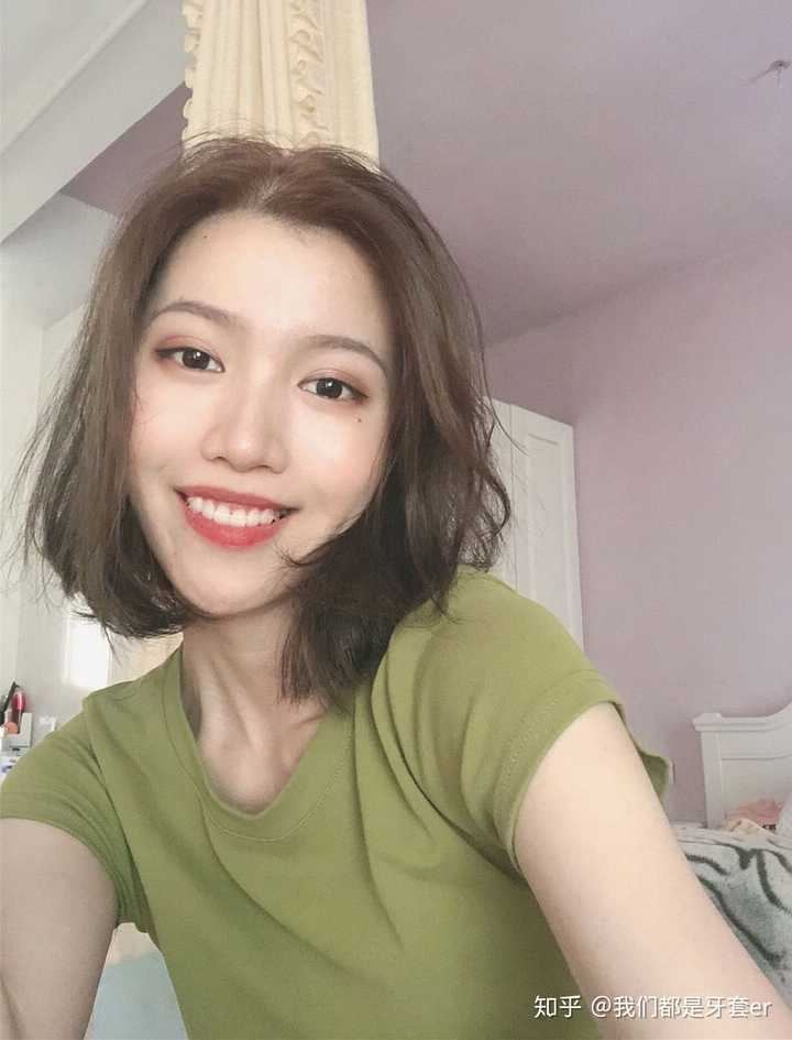 排齐收缝阶段好像牙齿更凸凸凸了