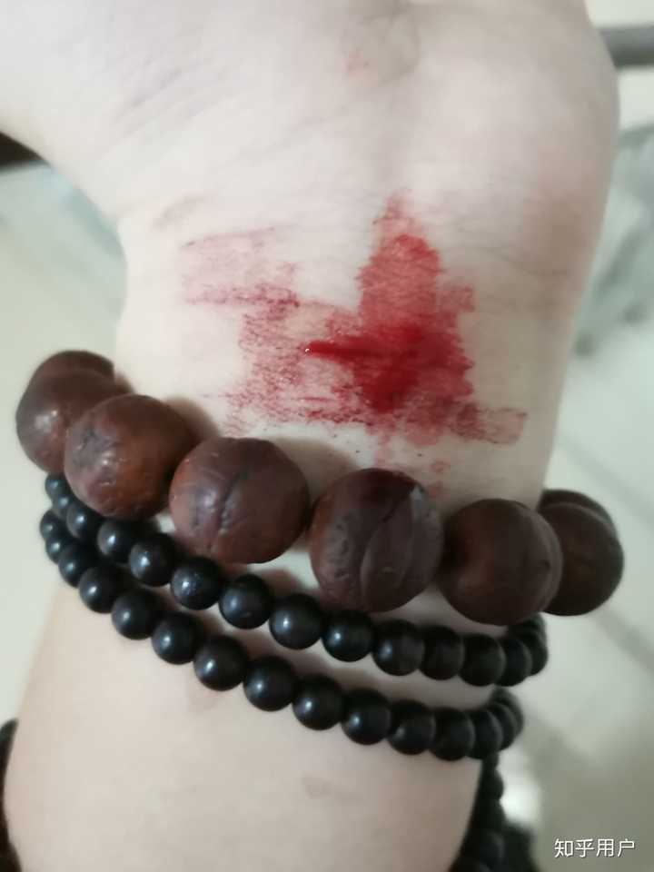 患有抑郁症是种什么感受?