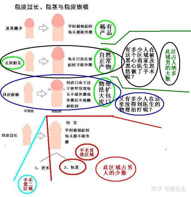 我明早要去本地医院做包皮手术,知乎上的网友们能不能给些建议?