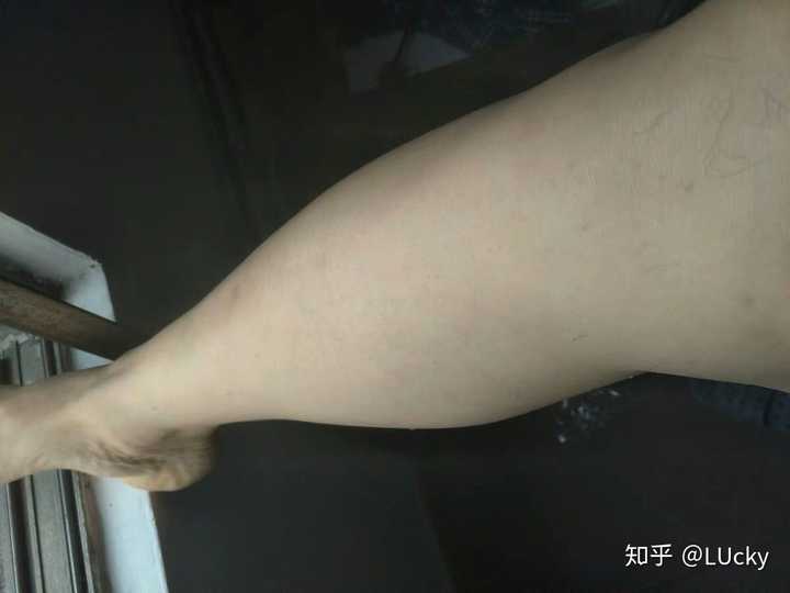 腿毛茂盛的男生夏天应该刮腿毛吗?