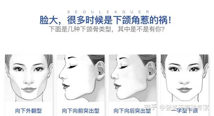脸大,很多时候都是下颌角惹的祸,你是哪一种下颌骨类型?