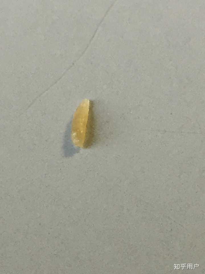 史上最大的黑头有多大?