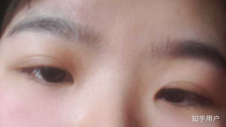 半垂眼状态