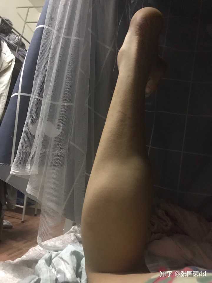男生跟腱长是一种怎样的体验