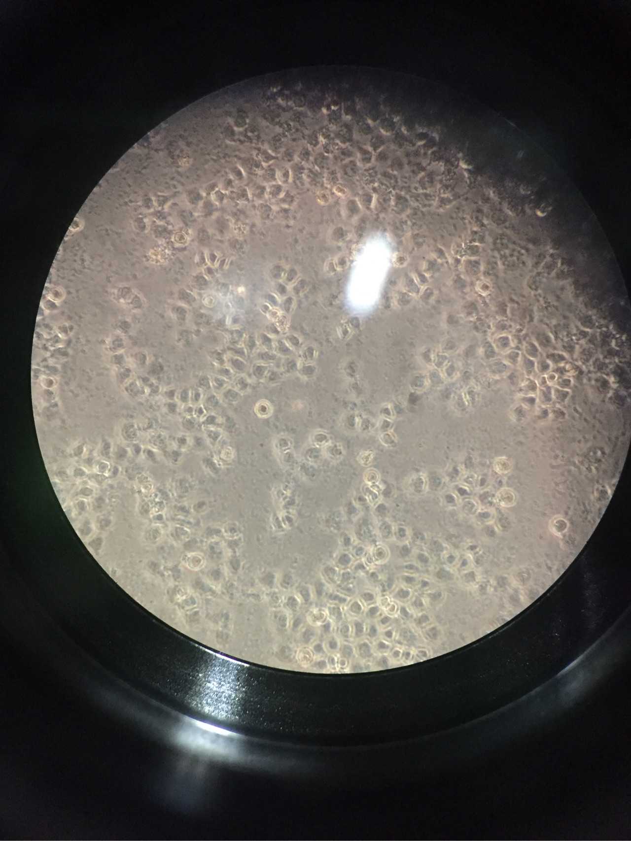 细胞的黑胶虫,在dxy上查了很多,最后猜测可能为细菌污染外加黑胶虫