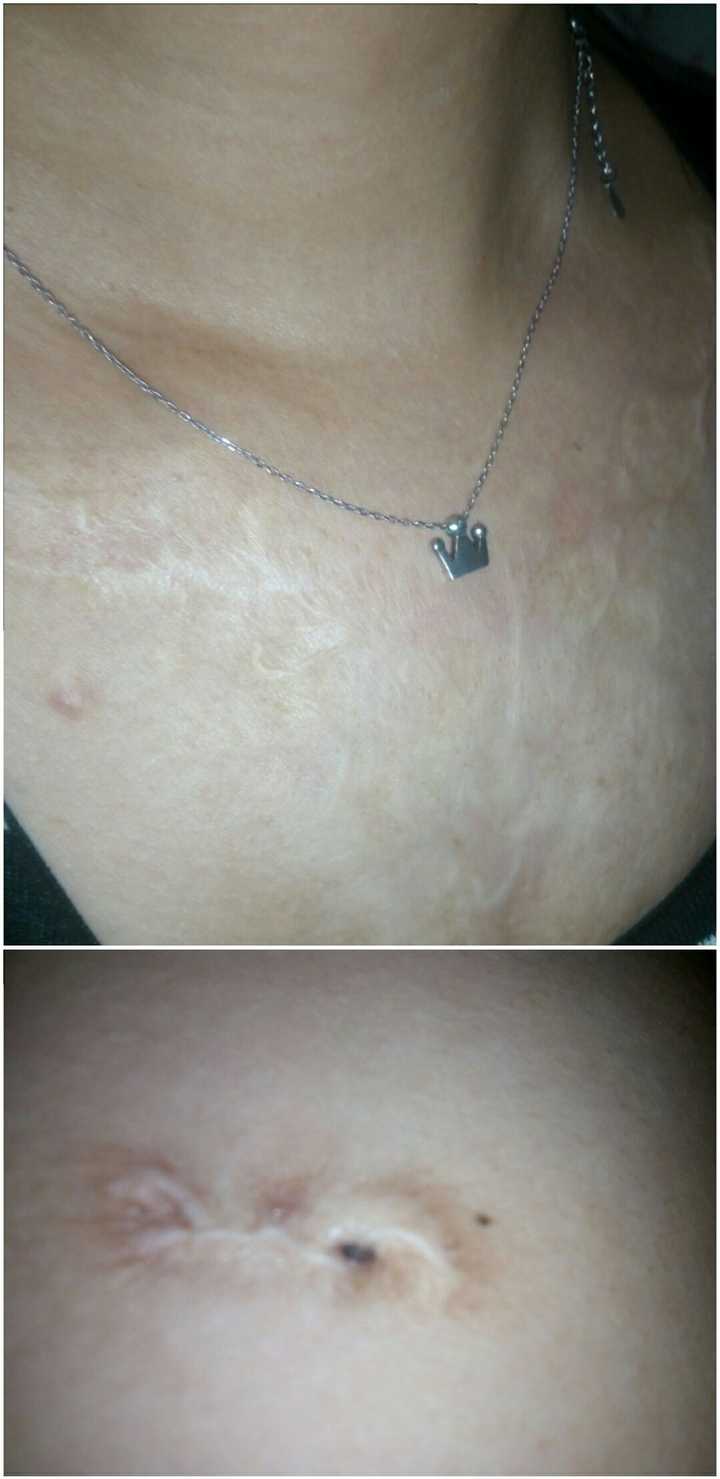 男性是如何看待女性的疤痕的?