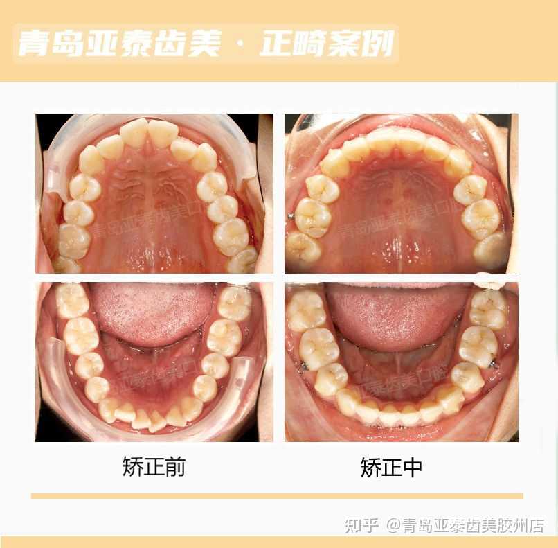 整齐牙齿含笑嘴角微笑杰作