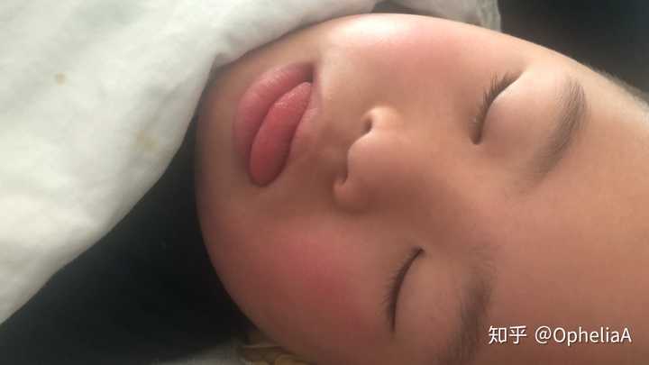 发现朋友的孩子是唐氏儿,我该开口吗?