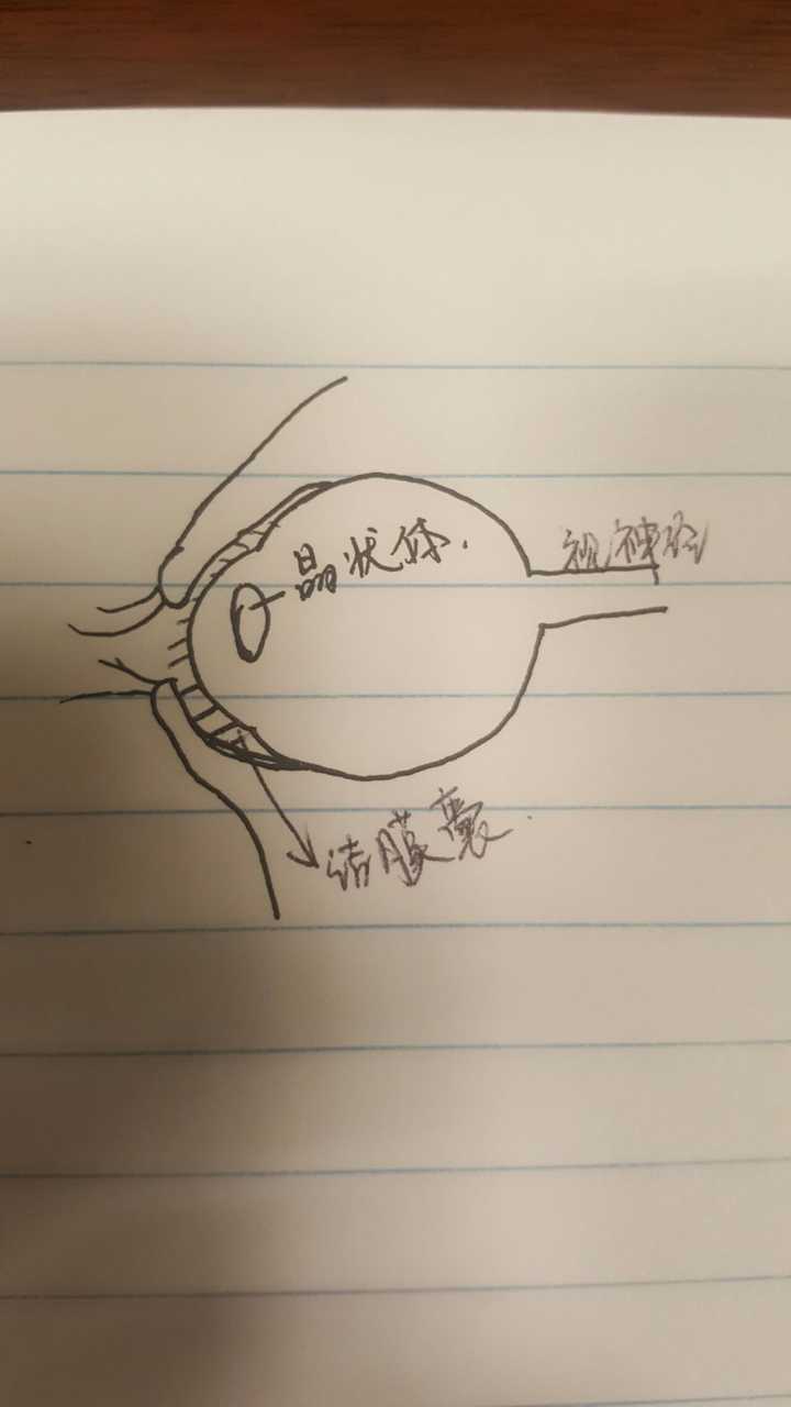 而结膜囊内会有泪液不断的冲刷,将异物排出