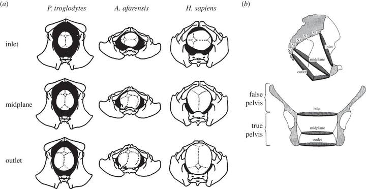 婴儿头部在产道的三个主要平面上的位置显示.