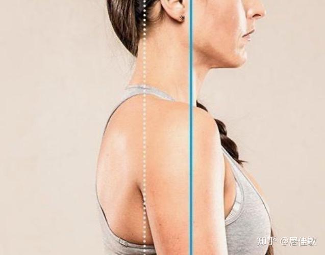 肩膀锁骨胸之间的三角肌发达怎么减?