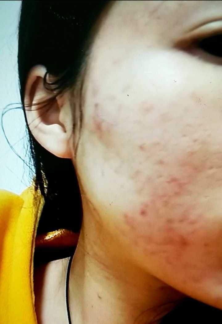 如何全面系统地内调外养,包括去湿气,肠胃保养,补血气