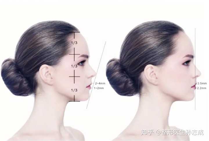 美女的侧脸不够美的地方在于,鼻子(矮,侧面轮廓线(苹果肌扁平,下颌