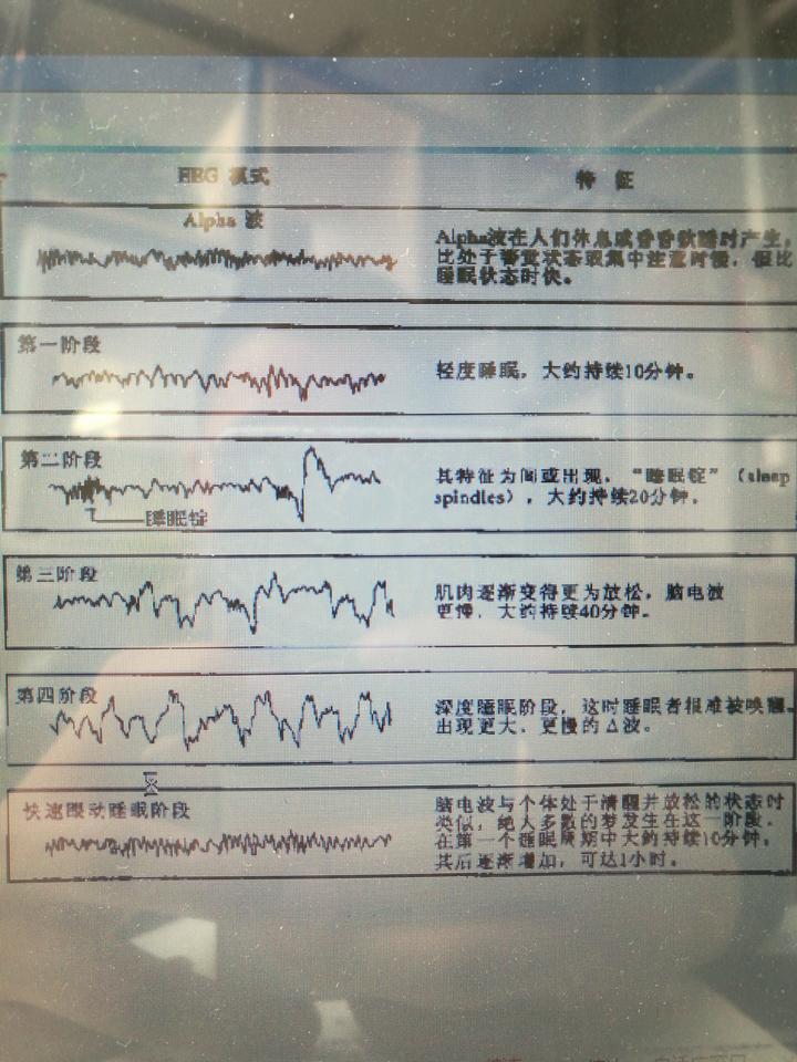 人睡眠阶段的脑电波形图