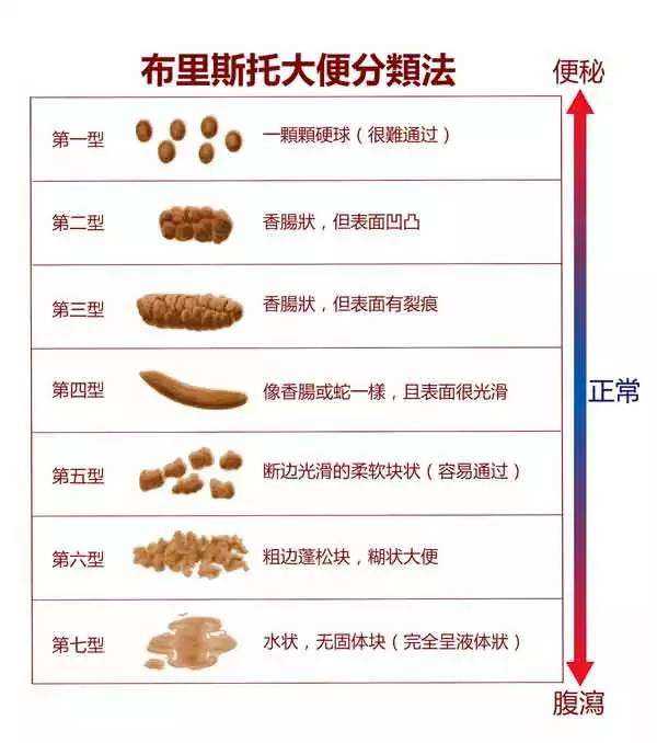 大便哪种状态表示身体最健康?