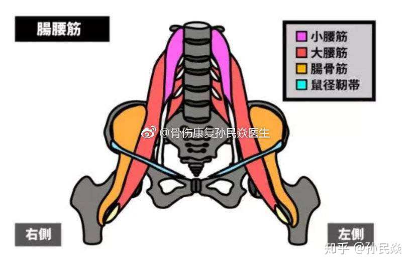 腹股沟(大腿根)疼痛的主要病种有