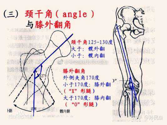 孙民焱 的想法: 颈干角 股骨颈的长轴与股骨干纵轴之间形… - 知乎