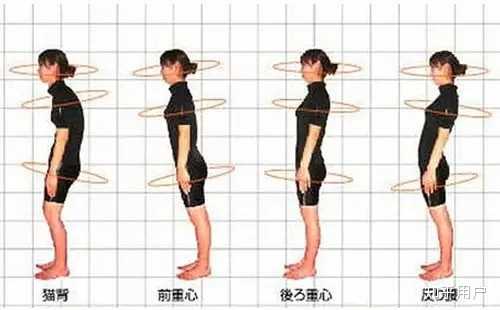 女生有点驼背,怎么改善?