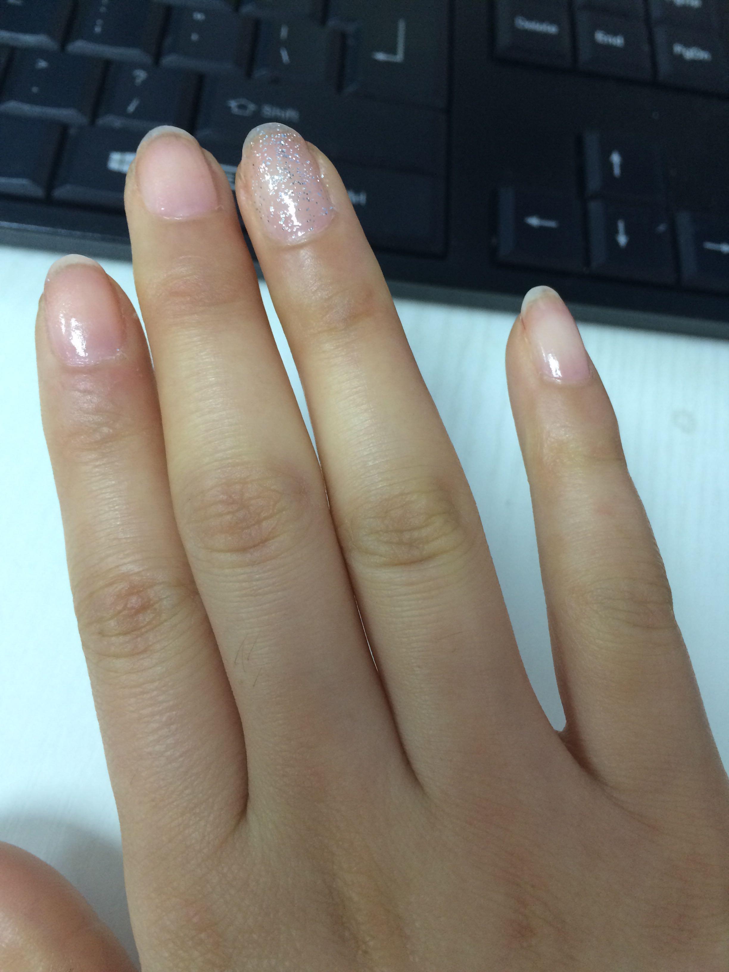手指关节发黑是怎么回事?如何改善? ?