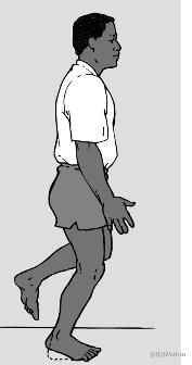 脚踝关节疼痛,多次崴脚造成,该怎么去应对呢?