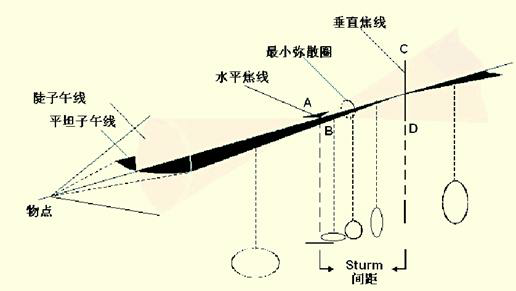 眼科等效球镜究竟是什么含义呢