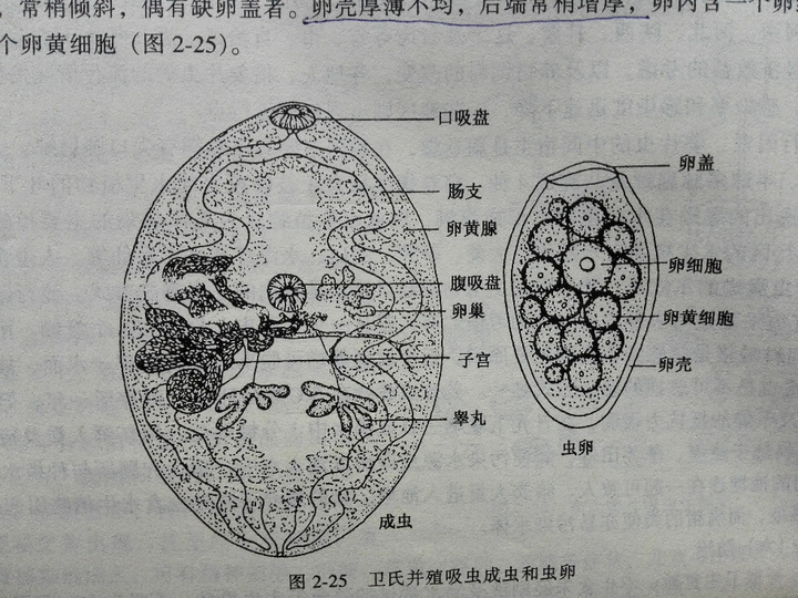 卫氏并殖吸虫成虫主要寄生在肺部,简称肺吸虫.