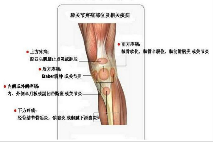 女性,核磁共振结果:双腿均膝关节前交叉韧带损伤,半月