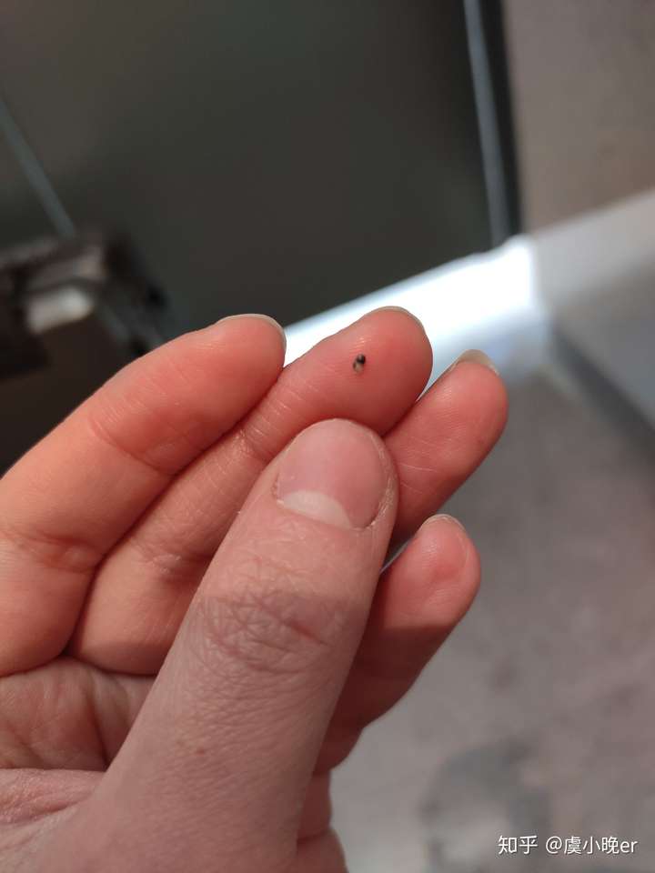 史上最大的黑头有多大?