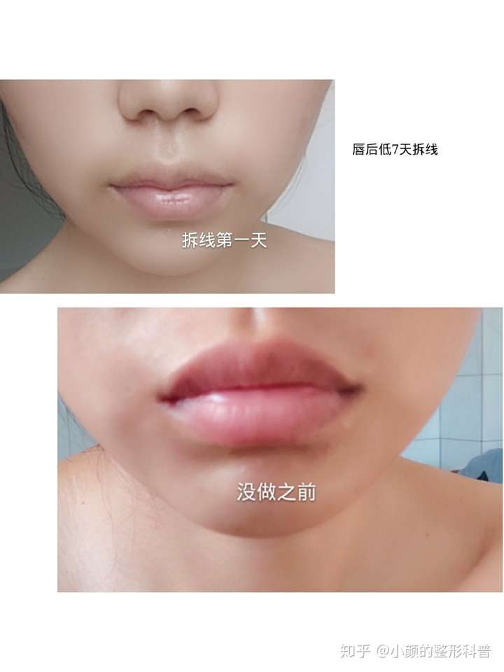 什么样的m唇做出来很好看!