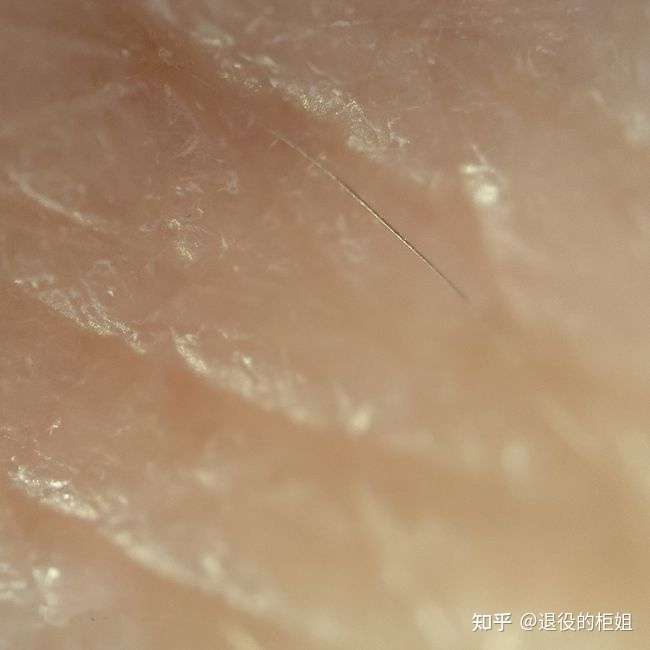 神经酰胺流失严重,通俗点讲,维持肌肤屏障砖墙结构的"水泥粘合剂"缺少